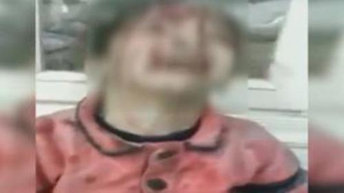 YÜREK PARÇALAYAN GÖRÜNTÜ