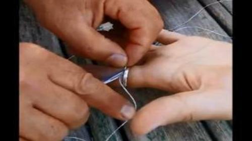 PARMAĞINIZA SIKIŞAN YÜZÜĞÜ NASIL ÇIKARIRSINIZ?