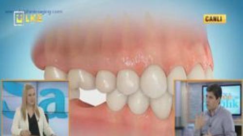 ÖNCE SAĞLIK - 28 HAZİRAN 2014