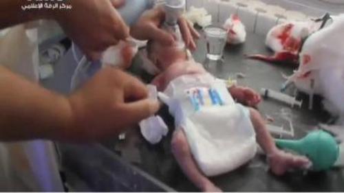 SURİYELİ BEBEK BAŞINDA ŞARAPNEL PARÇASIYLA DOĞDU