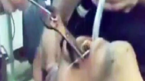 MİDESİNDEN ÖYLE BİR ŞEY ÇIKTI Kİ